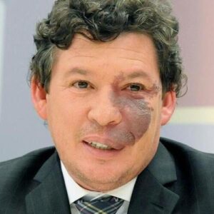 Reginaldo Lopes