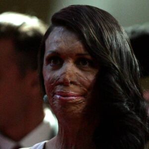 Turia Pitt