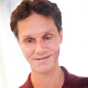 Daniel Kish