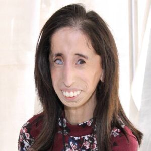 Lizzie Velasquez